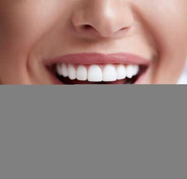 Kvinna med vita tänder